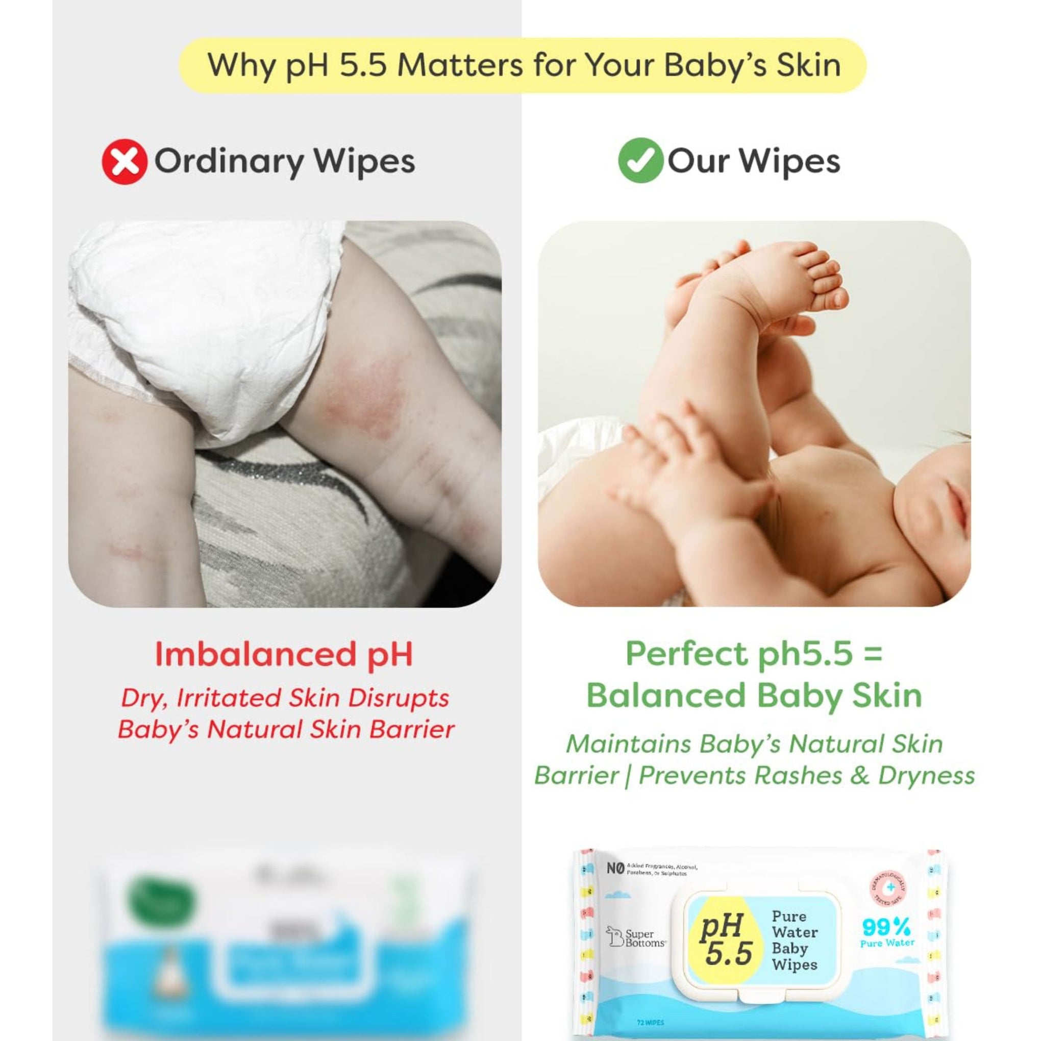 SuperBottoms pH 5.5 Pure Water Baby Wipes – 144 Pieces (Pack of 2), 99% Water, 3x Thicker