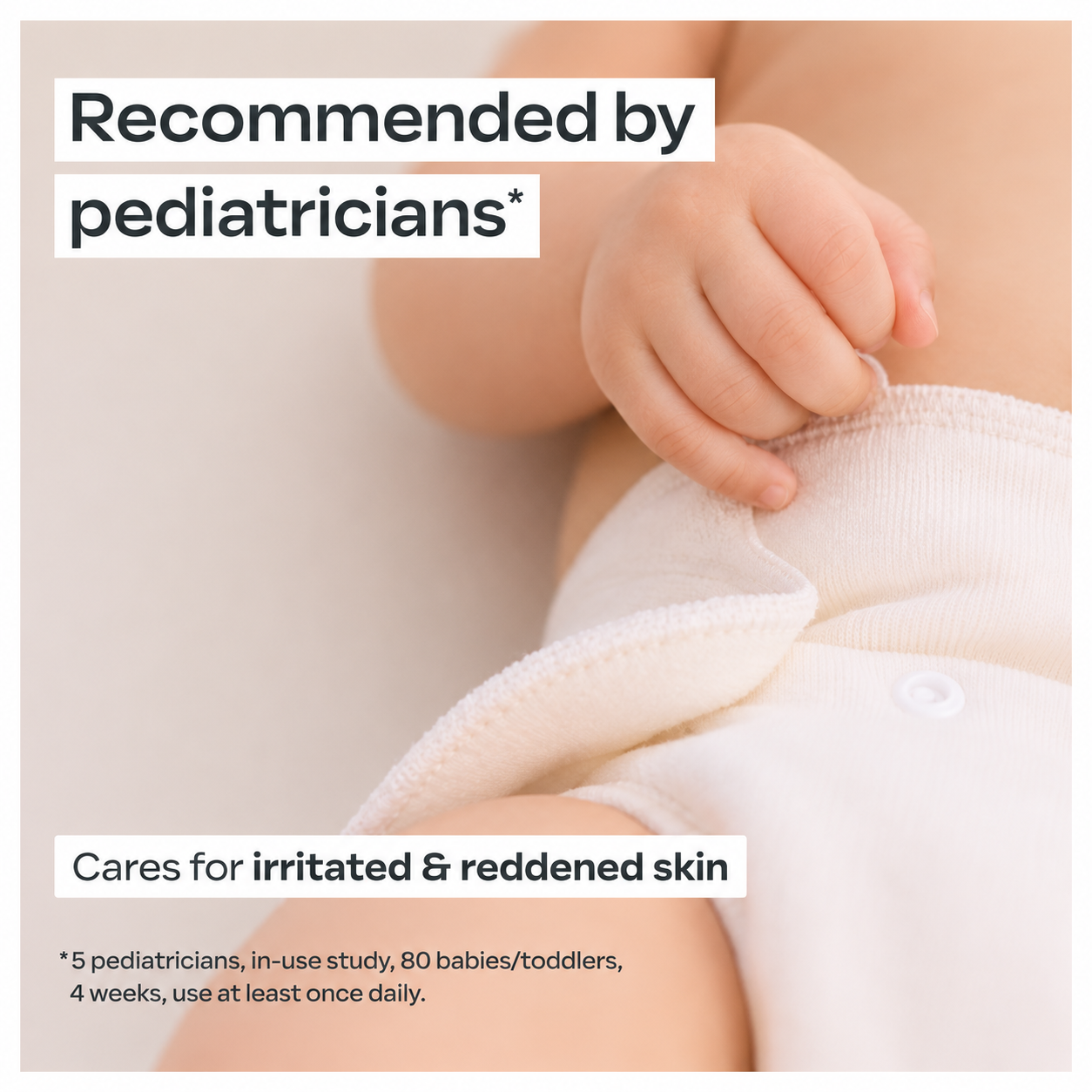 Weleda Baby Nappy Change Cream 30ml | Organic Calendula Diaper Rash Cream | Protects, Soothes & Regenerates Sensitive Baby Skin