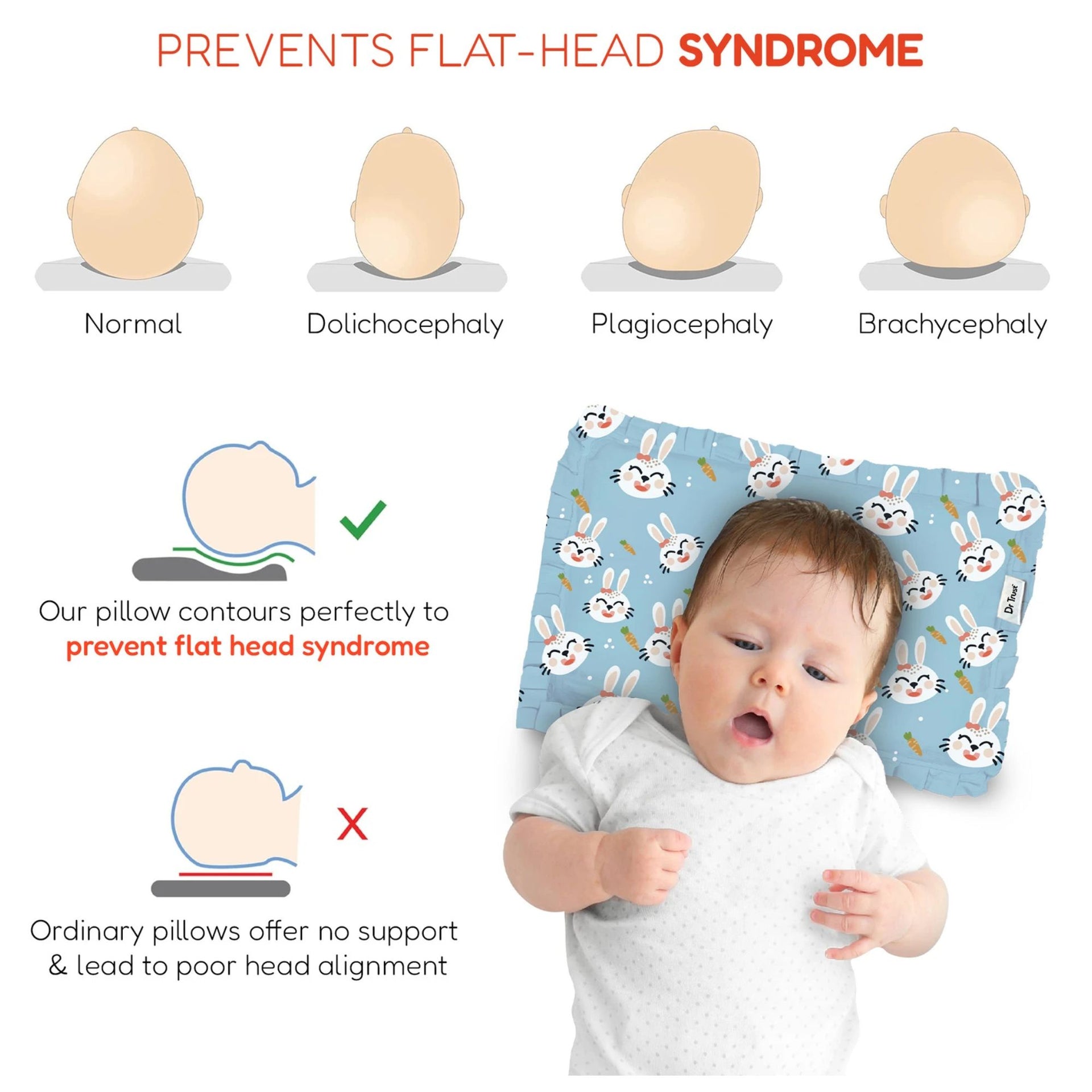 Smile Baby Mustard Seed Head Shaping Pillow for Newborn Babies | Soft Cotton Cover | Breathable & Washable | Prevents Flat Head Syndrome | Baby Support Pillow (Blue Bird Print)